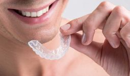 What Benefits Does Invisalign Offer?